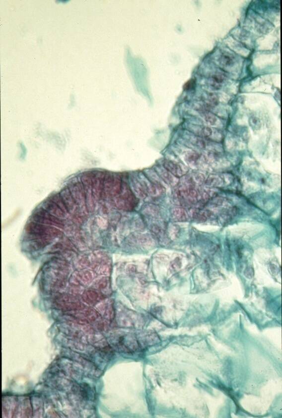 Micrograph of somatic ebryo in the development stage.